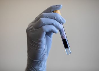 Un informe del Reino Unido revela que se encubrió un escándalo de sangre infectada que duró décadas |  Noticias de Salud