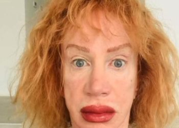 Kathy Griffin, que odia a Trump, no puede hablar después de su última cirugía |  El experto en puerta de enlace