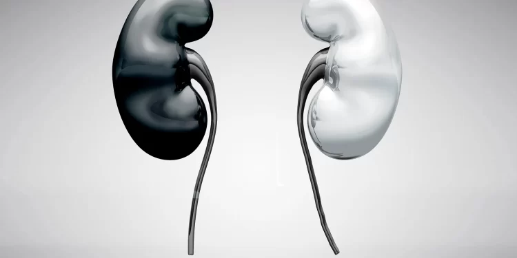 Eliminando el racismo de la ecuación de la enfermedad renal