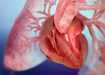 ¿Qué hay detrás del importante aumento de las muertes por insuficiencia cardíaca?