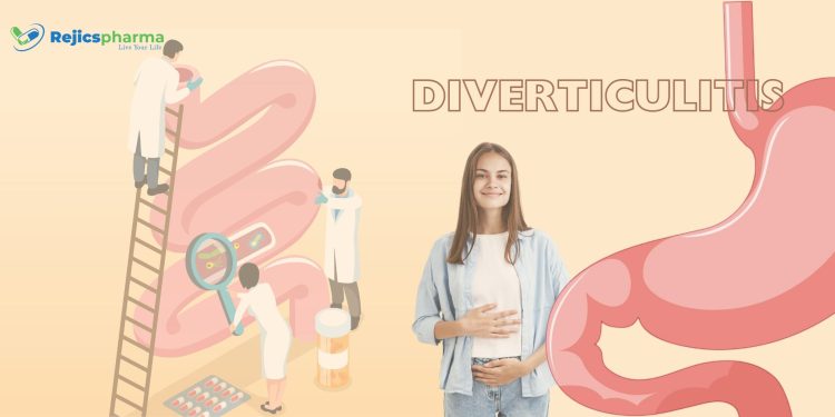 diverticulitis