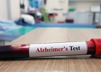¿Debería hacerse un análisis de sangre para detectar la enfermedad de Alzheimer?