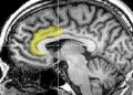 Científicos identifican circuito cerebral que podría revelar secretos del alivio del dolor con placebo