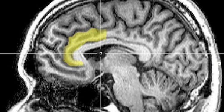 Científicos identifican circuito cerebral que podría revelar secretos del alivio del dolor con placebo