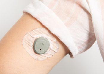 Dexcom Stelo: un dispositivo de venta libre en la guerra contra la diabetes