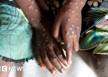 Nueva cepa declarada emergencia de salud pública continental