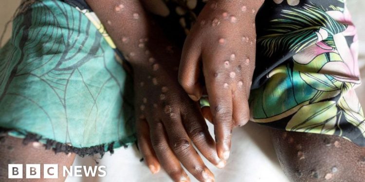 Nueva cepa declarada emergencia de salud pública continental