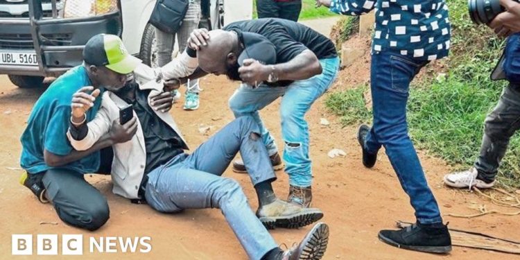 Bobi Wine, el principal líder de la oposición de Uganda, herido en un altercado con la policía