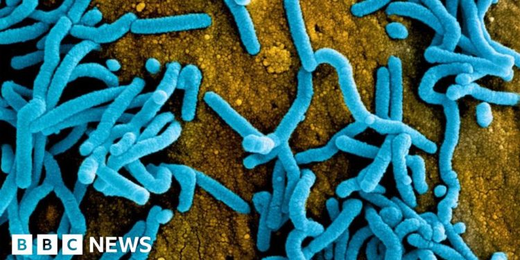 Ruanda restringe el tamaño de los funerales tras el brote