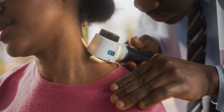 ¿Qué es el melanoma y por qué están aumentando las tasas de melanoma?