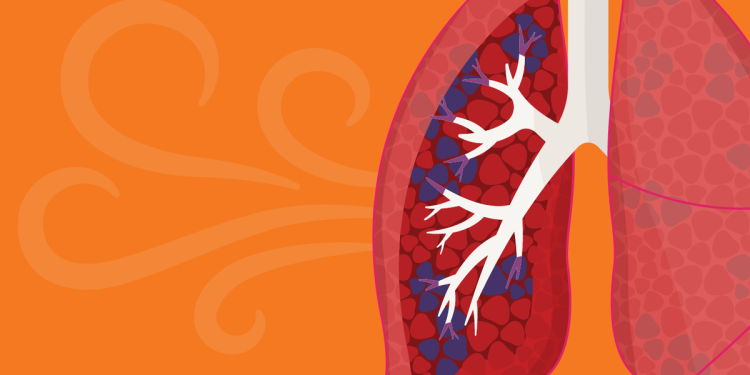 Tratamientos eficaces para la EPOC: una guía completa