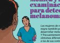 Mónica y la exploración para detectar melanoma