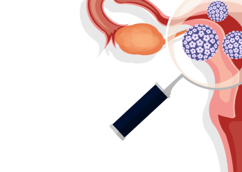 Vacunación del VPH en todo el mundo