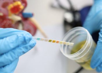 10 causas posibles de sangre en la orina