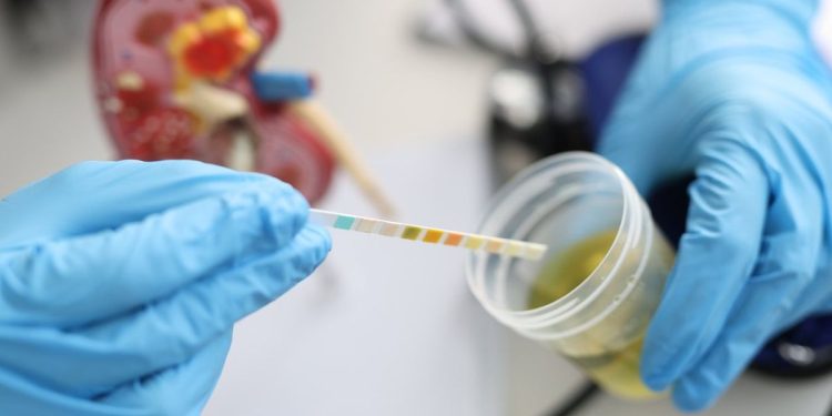 10 causas posibles de sangre en la orina