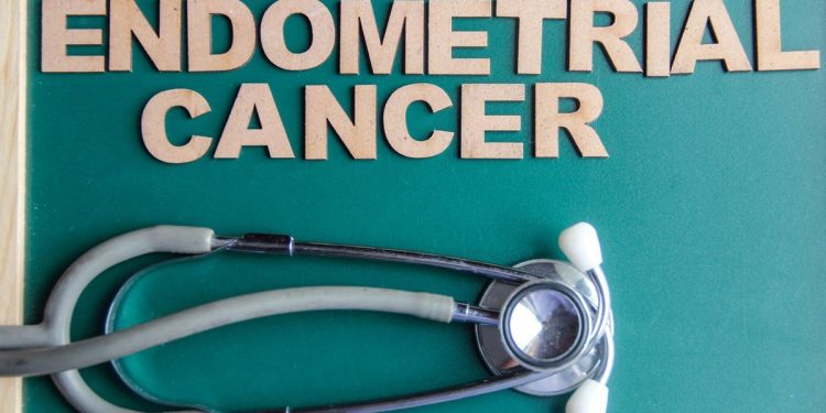 Preguntas y respuestas sobre el cáncer de endometrio