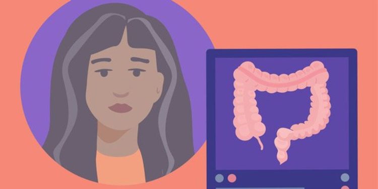 Salud mental y cáncer de colon
