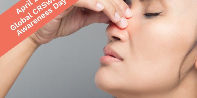 Hechos sobre pólipos nasales – Homenwomen