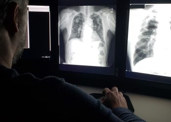 La potencia pulmonar alcanza su punto máximo en nuestros 20 años, y es una disminución constante a partir de ahí, el estudio encuentra