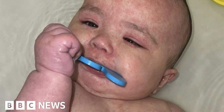 Cómo Canadá se convirtió en el centro de un brote de sarampión en América del Norte