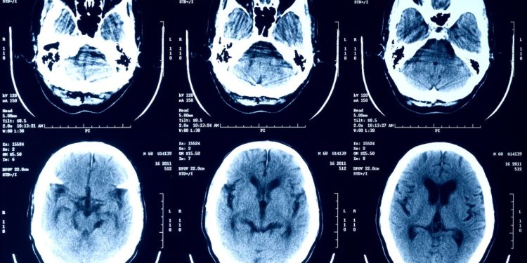 Episource está notificando a millones de personas que sus datos de salud fueron robados