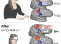 El estudio de las extremidades fantasmas vuelve a cablear nuestra comprensión del cerebro