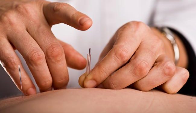 El tratamiento con acupuntura mejora los efectos incapacitantes del dolor lumbar crónico en adultos mayores