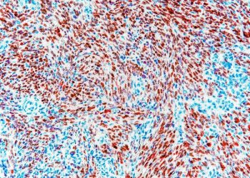 Financiación de la investigación del cáncer infantil respaldada por el HHS Duplica AI