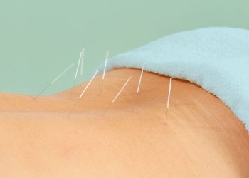 La acupuntura para el dolor de espalda puede funcionar mejor que las drogas o la fisioterapia