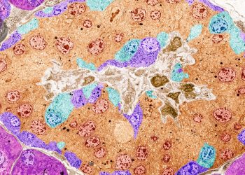 Las células editadas por CRISPR bombean la insulina en una persona y evaden la detección inmune