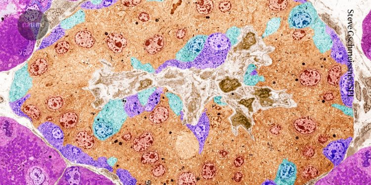 Las células editadas por CRISPR bombean la insulina en una persona y evaden la detección inmune