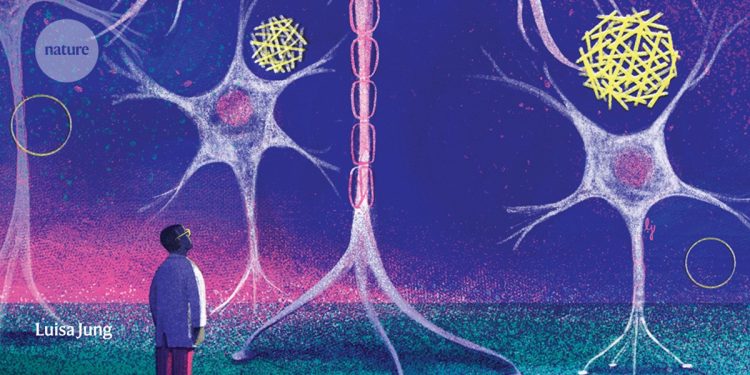 Nueva esperanza en la investigación de Alzheimer