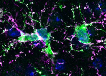 Cambiar células inmunes viejas en el cerebro con otras frescas podría tratar la enfermedad