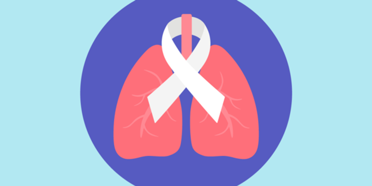 Síntomas del cáncer de pulmón – mujeres saludables