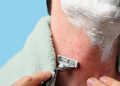 ¿Qué es la afeitadora de afeitar? Síntomas, causas, diagnóstico, tratamiento y prevención