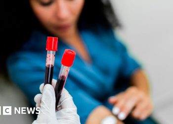 Emocionantes resultados de análisis de sangre para 50 cánceres