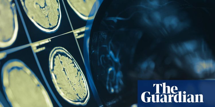 La inyección inteligente puede reducir los tumores cancerosos de cabeza y cuello en seis semanas, según un ensayo | Investigación del cáncer