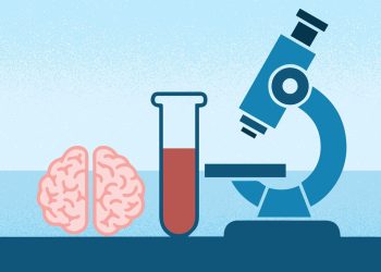 El análisis de sangre Elecsys para el Alzheimer obtiene la autorización de la FDA