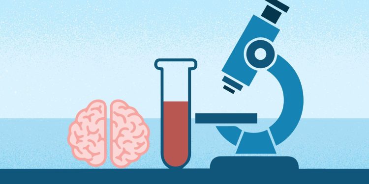 El análisis de sangre Elecsys para el Alzheimer obtiene la autorización de la FDA