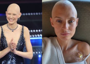 La modelo con cáncer que Victoria's Secret no quiso en su pasarela