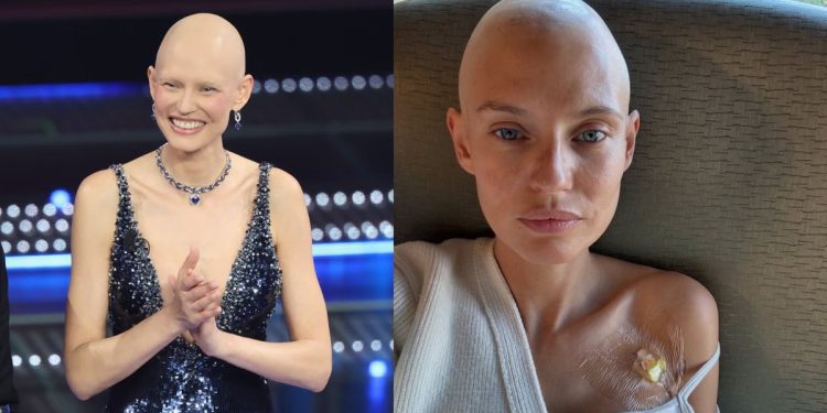 La modelo con cáncer que Victoria's Secret no quiso en su pasarela