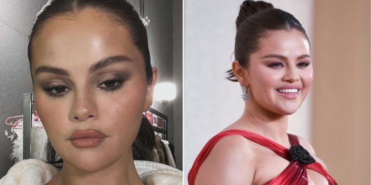 Por qué el Lupus cambió totalmente cómo se veía