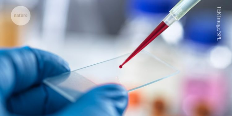 Primer análisis de sangre propuesto para el síndrome de fatiga crónica: lo que piensan los científicos