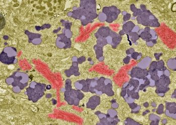 Los análisis de sangre ya están aprobados para el Alzheimer: ¿qué precisión tienen?