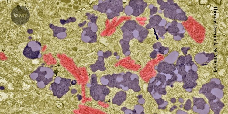 Los análisis de sangre ya están aprobados para el Alzheimer: ¿qué precisión tienen?