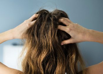 Los mejores remedios caseros para la picazón e irritación de la psoriasis del cuero cabelludo