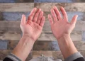 ¿Palmas rojas? Esto es lo que tu cuerpo intenta decirte