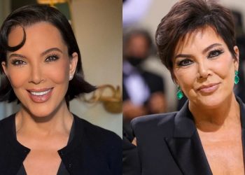 Por qué los 'arreglitos' ya no duran y el rostro se 'cae rápido' más