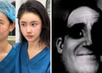 La perturbadora verdad detrás del facelift Chino que le está borrando la cara a las mujeres