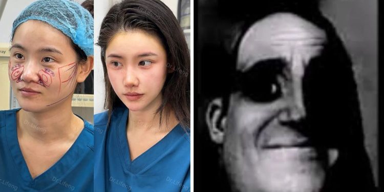 La perturbadora verdad detrás del facelift Chino que le está borrando la cara a las mujeres